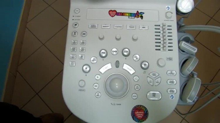 733_wosp_szpital_sprzet.mp4